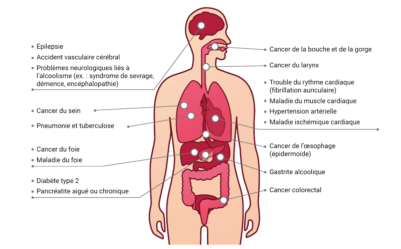 Quelles sont les conséquences neurologiques des troubles du