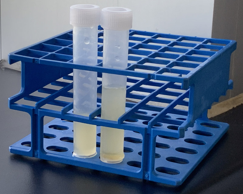échantillon d'urine