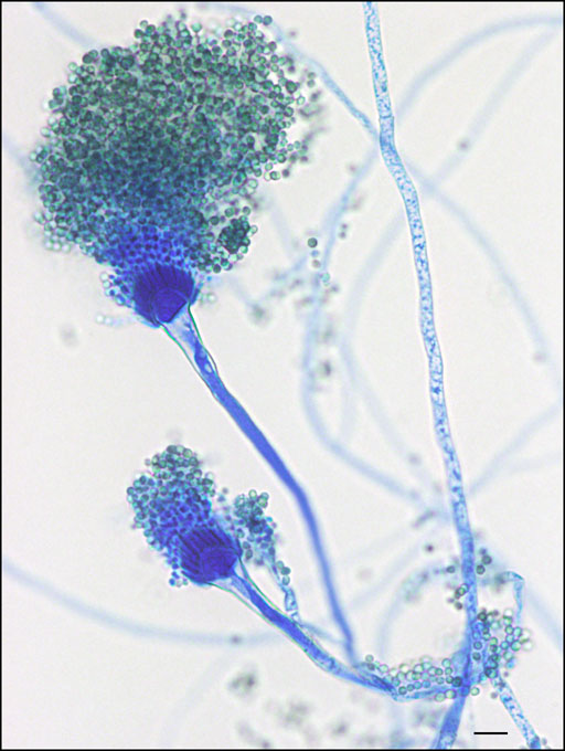 Aspergillus Fumigatus An Overview