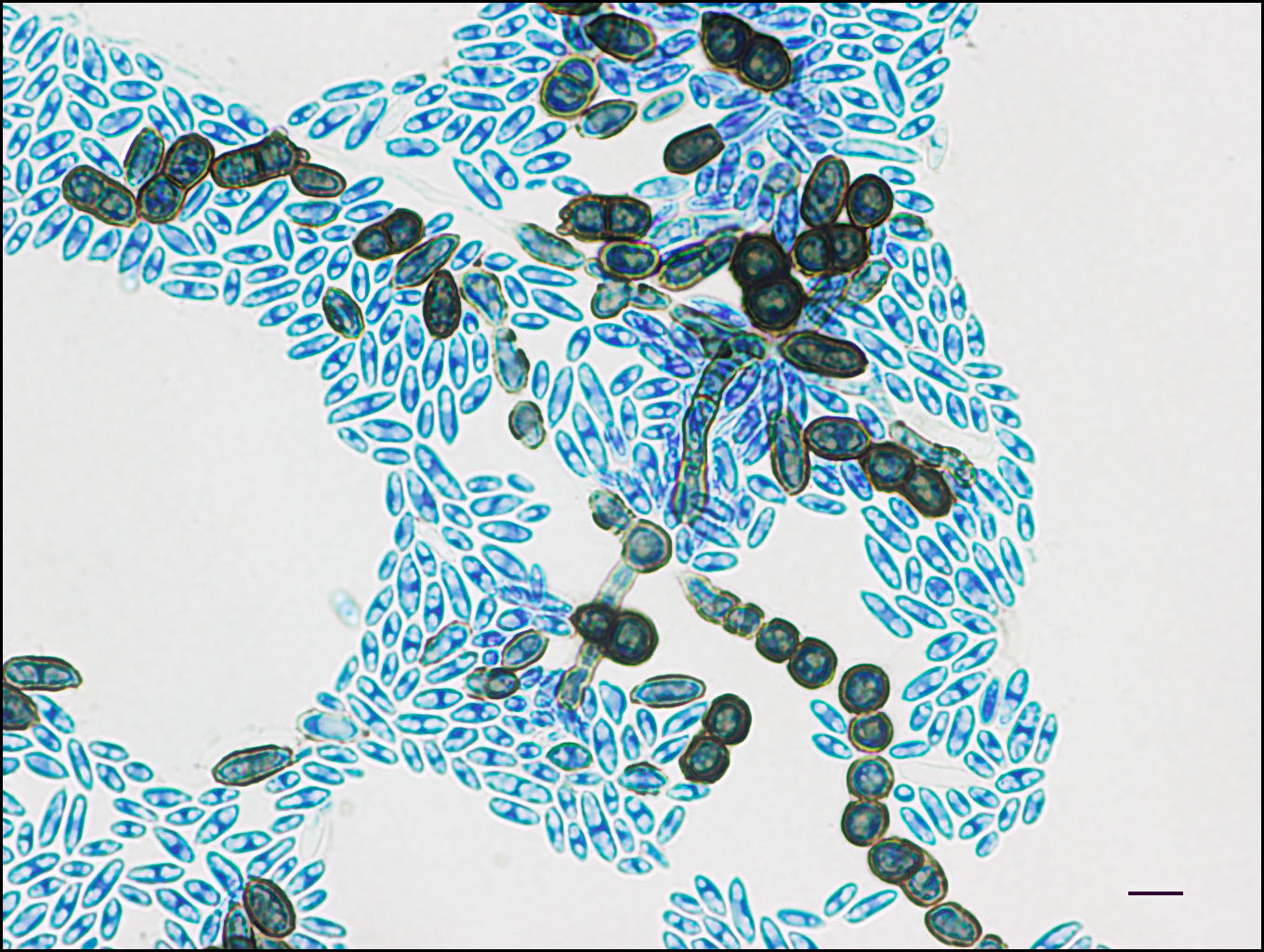 Aureobasidium Pullulans Institut National De Santé Publique Du Québec