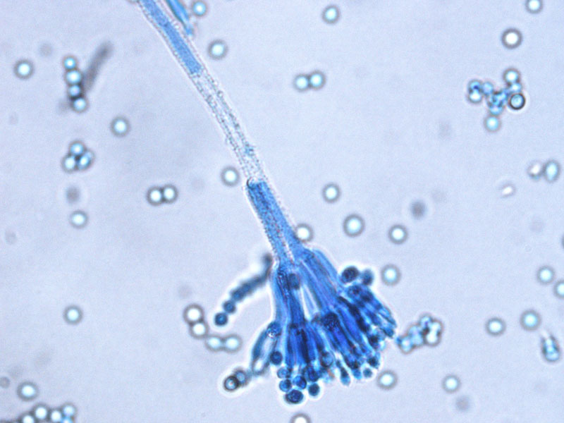 Penicillium sp. observé au microscope.