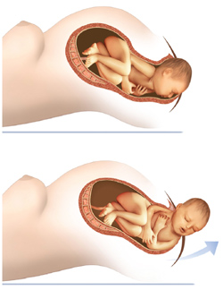 Accouchement : la naissance de bébé