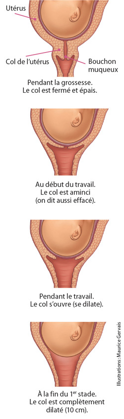 First stage: Thinning and opening of the cervix  Institut national de  santé publique du Québec