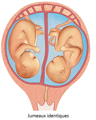 Les jumeaux identiques partagent le même placenta