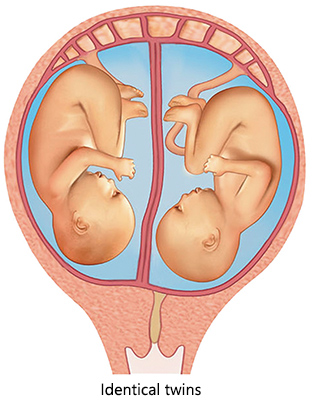 Identical twins usually share the same placenta.