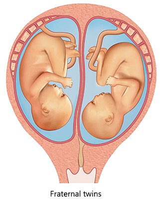 Non identical twins (fraternal twins) have their own placenta.