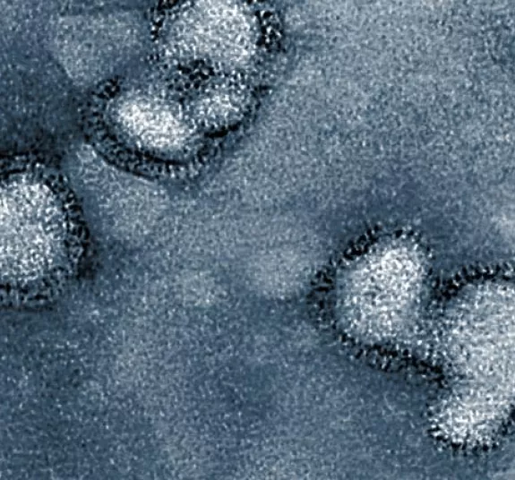 virus influenza